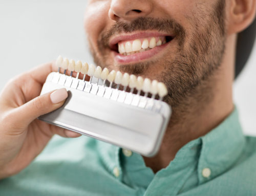 Consider Porcelain Veneers if You Have These 5 Dental Conditions