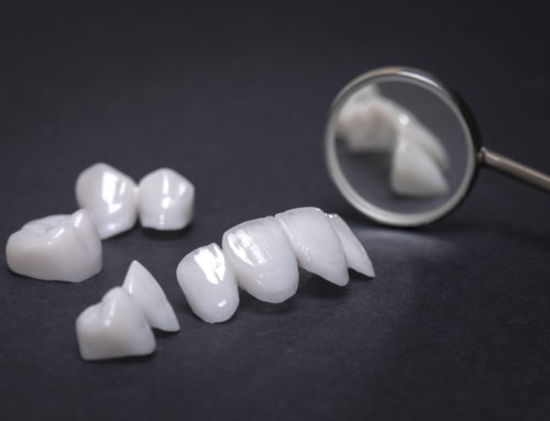 Dental Veneers vs. Crowns: What’s the Difference and Which is Right for You?